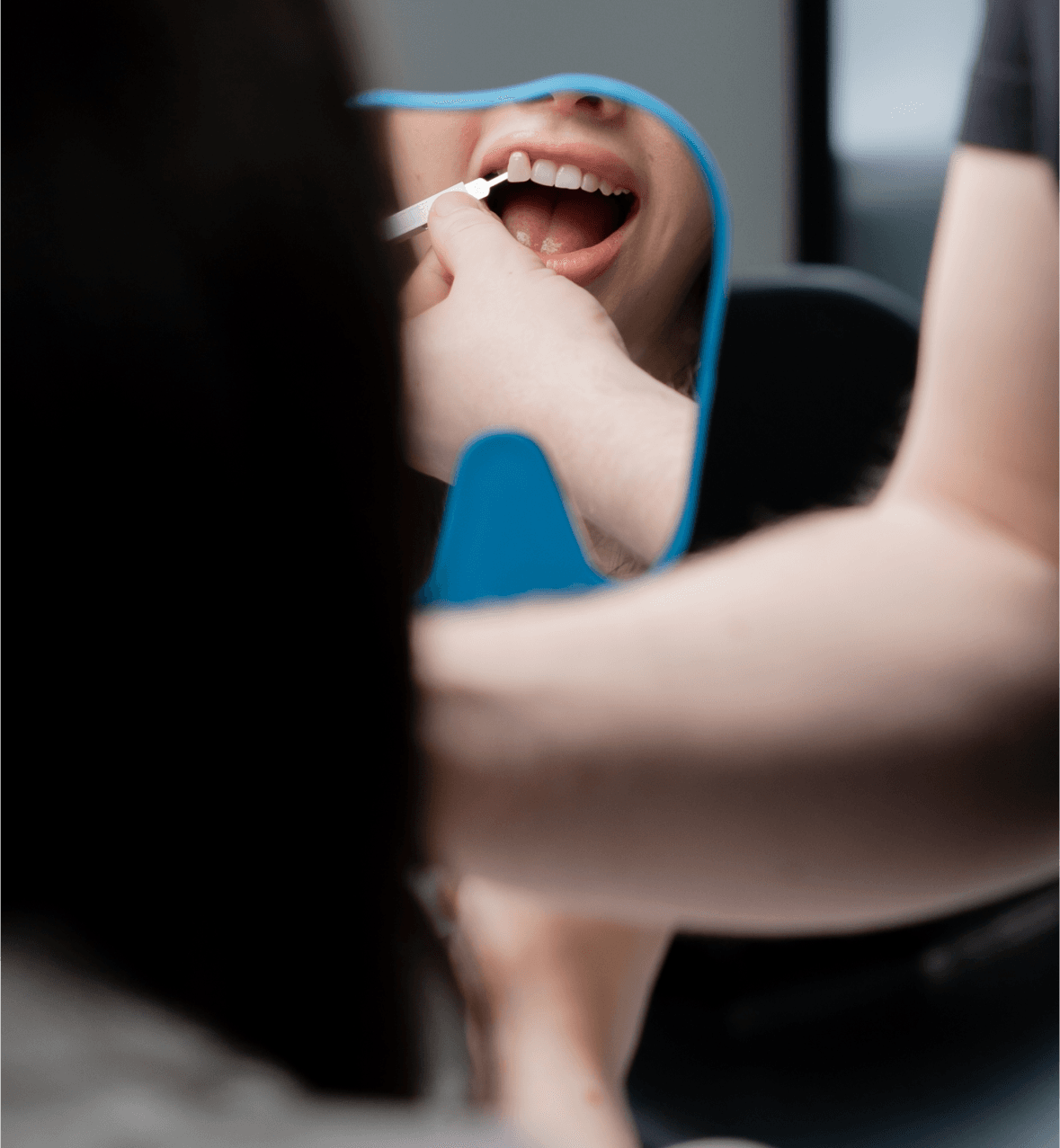 Teeth whitening preview